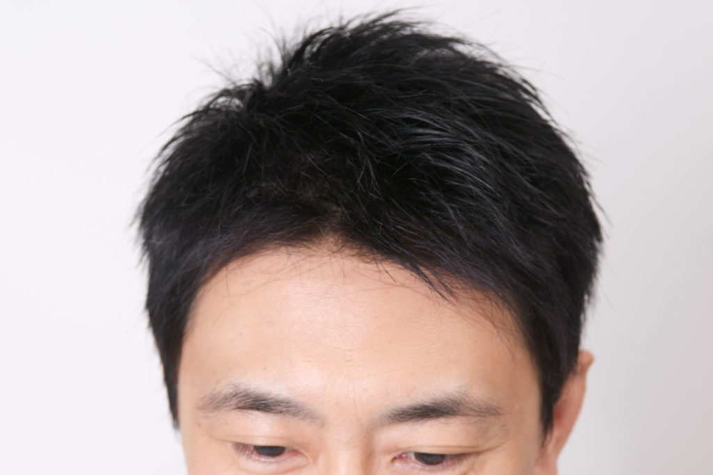 ウルトラソニックの詳細画像