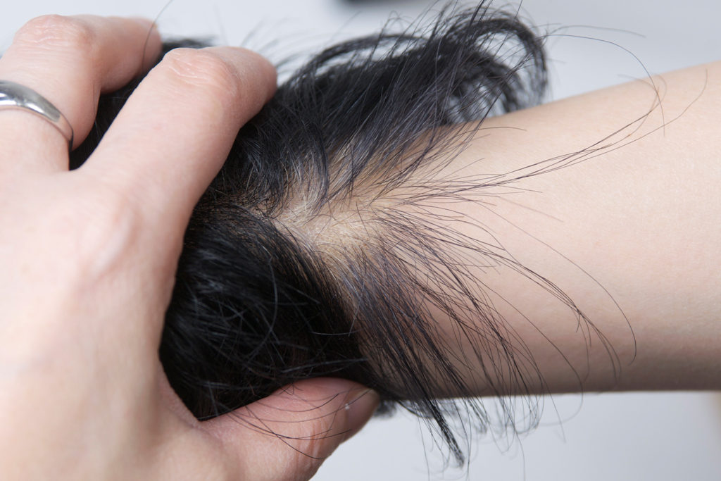 ウルトラソニックの詳細画像